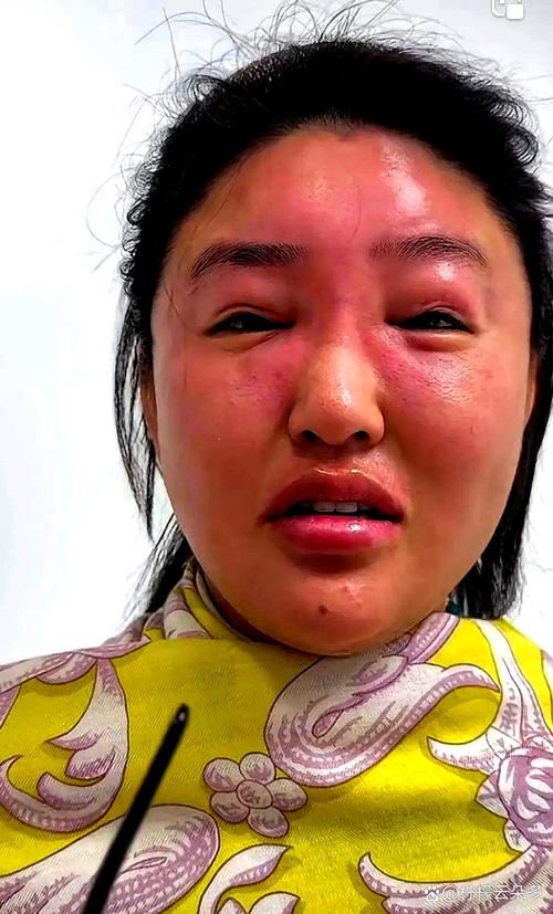 快手脸是畸形唱歌好听