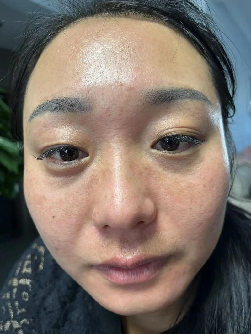 抖音上祛斑的是真的吗