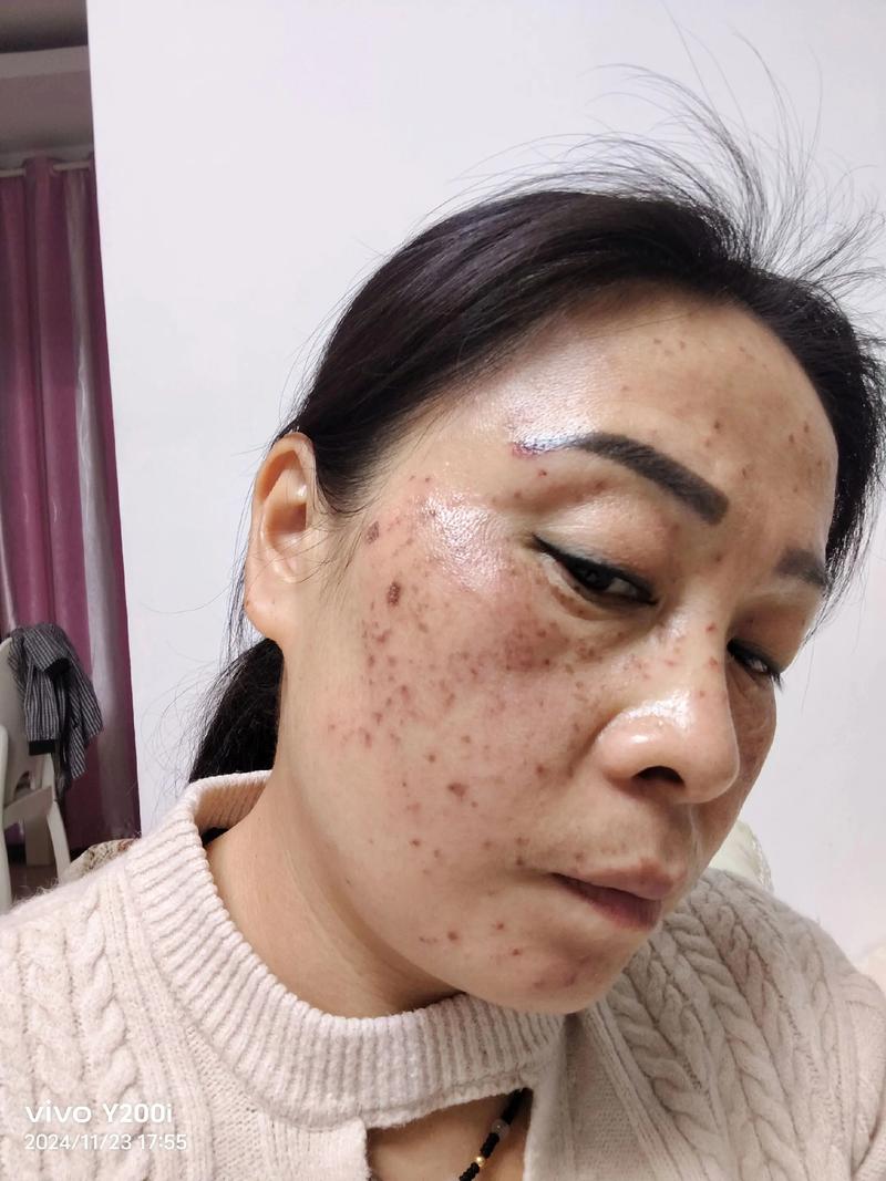 抖音上祛斑的是真的吗