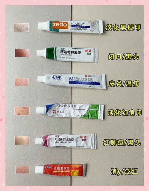 抖音上祛斑祛痘的药膏