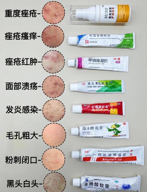 抖音祛痘印药膏排行榜