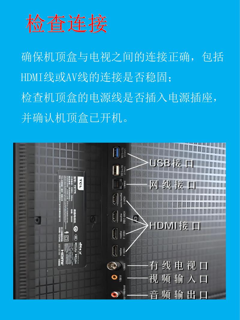 移动机顶盒怎么调直播