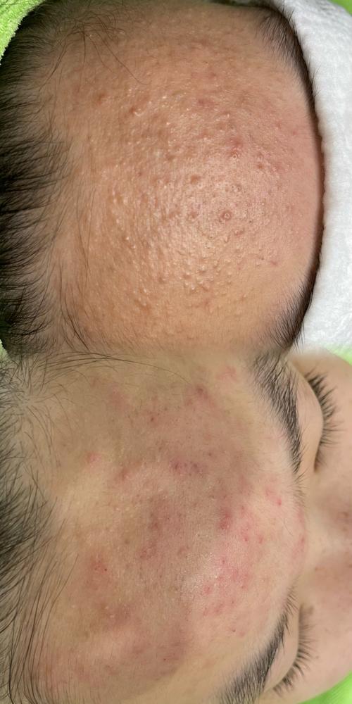 清洁脏脸抖音是真的吗