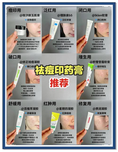 抖音祛痘药膏Pair