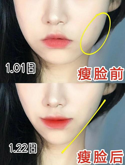 抖音是不是有瘦脸效果