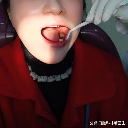 快手关关的牙是真的吗