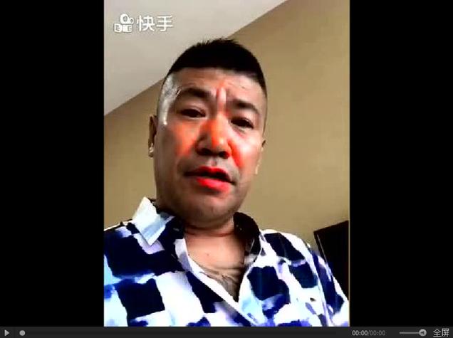 快手内蒙大伟被打视频