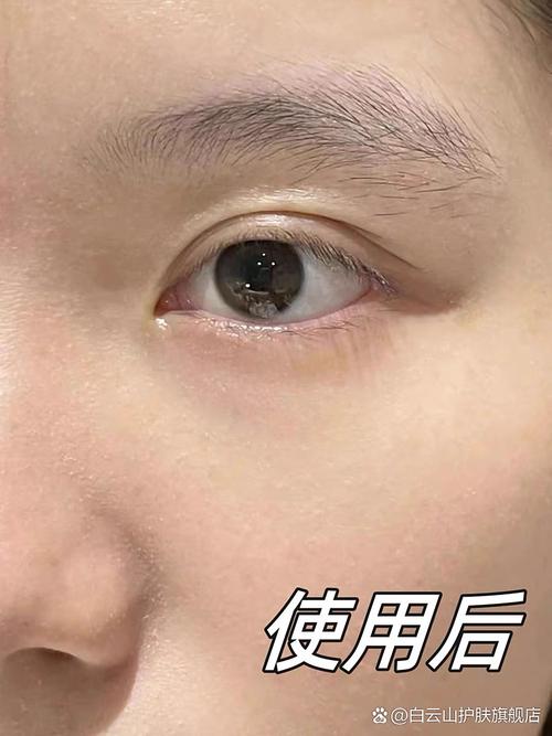 抖音同款双眼皮精华
