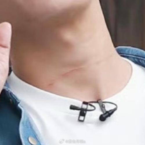 快手耀阳脖子的疤痕