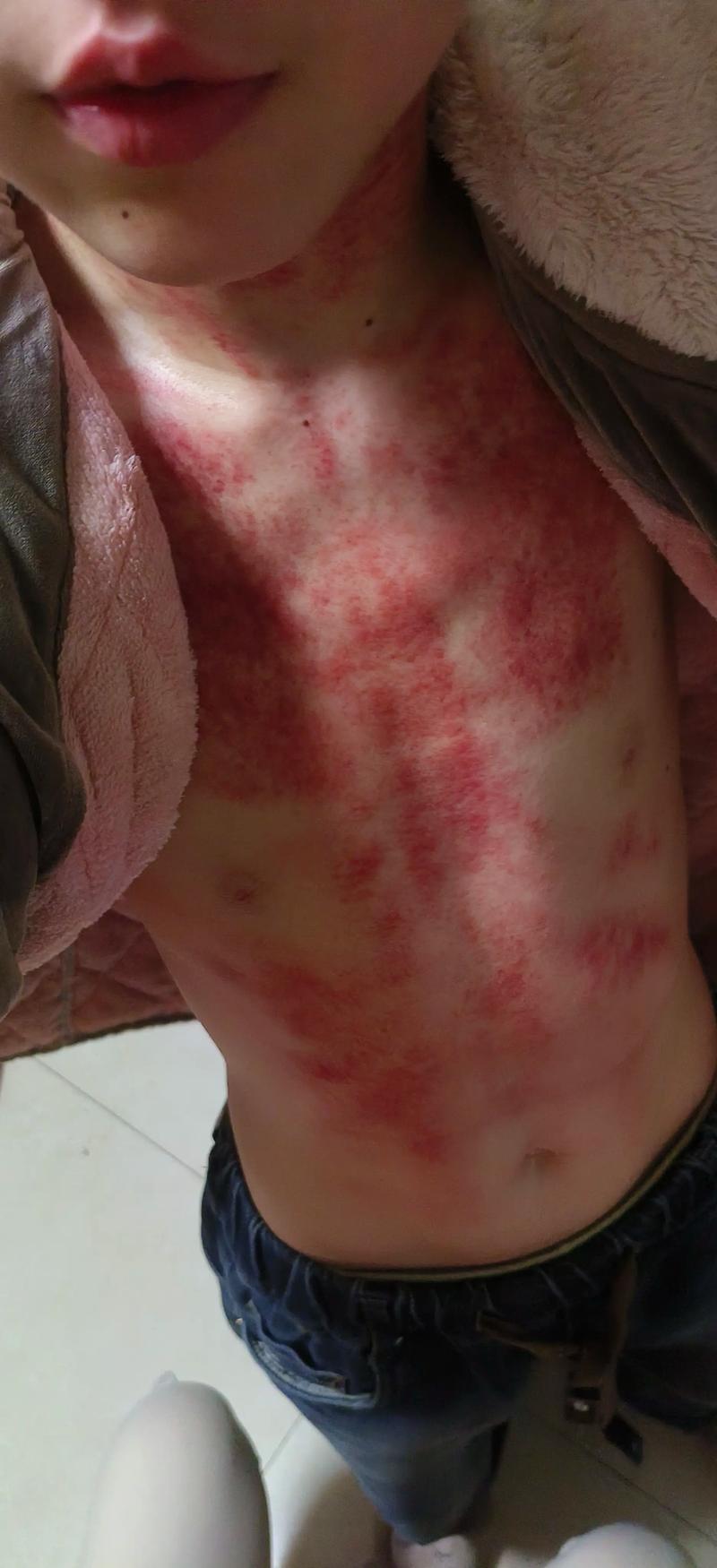 抖音心形刮痧板视频