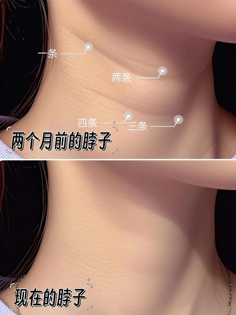 抖音有个护士弄脖子