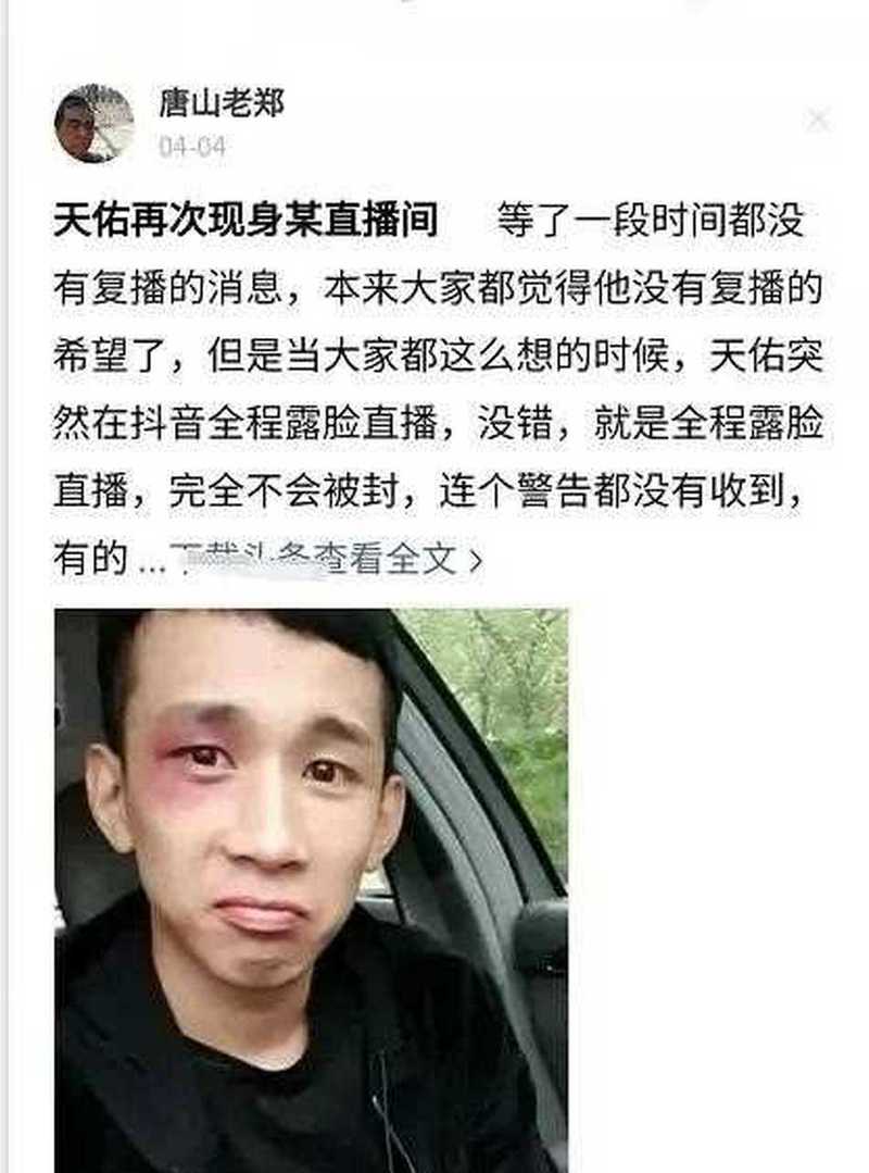 天佑在哪个平台直播