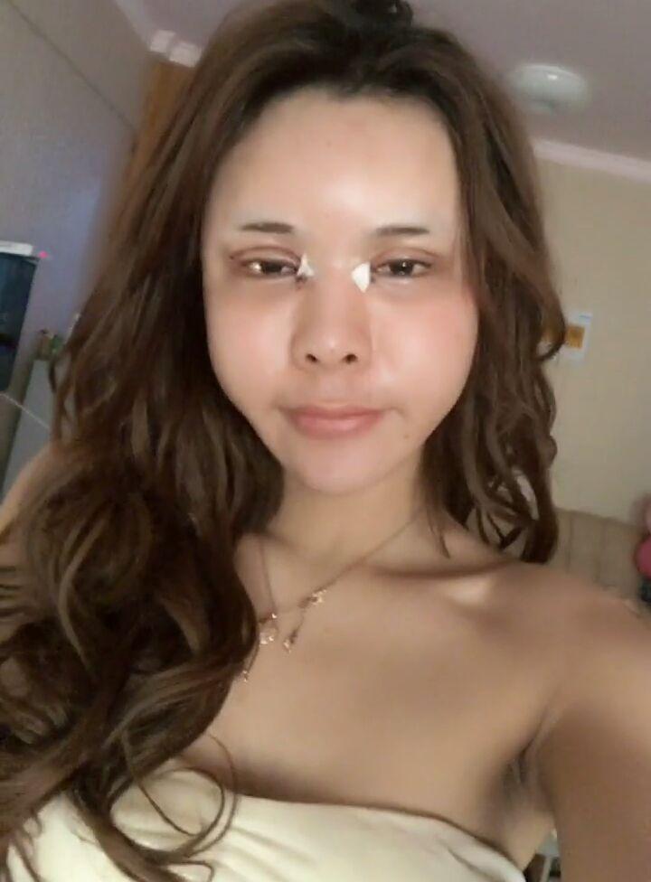 快手小不点是否整容