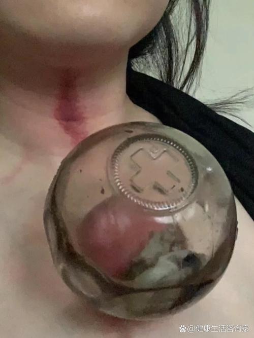 抖音上喷脖子的东西