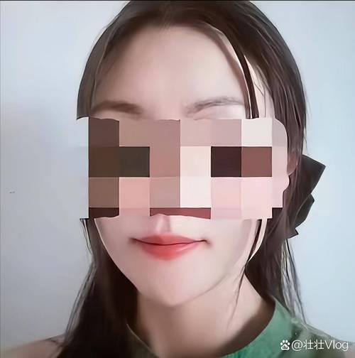 快手保定李冬梅整容