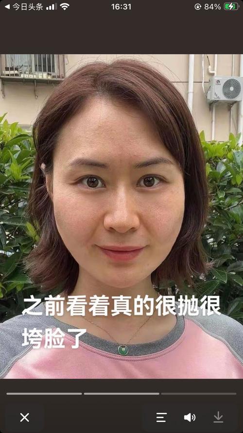 快手保定李冬梅整容